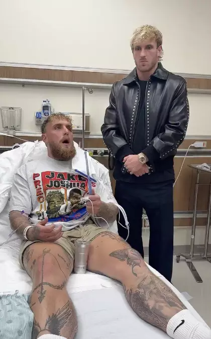 The boxer confirmed that he'd had surgery on his jaw (Instagram/jakepaul)