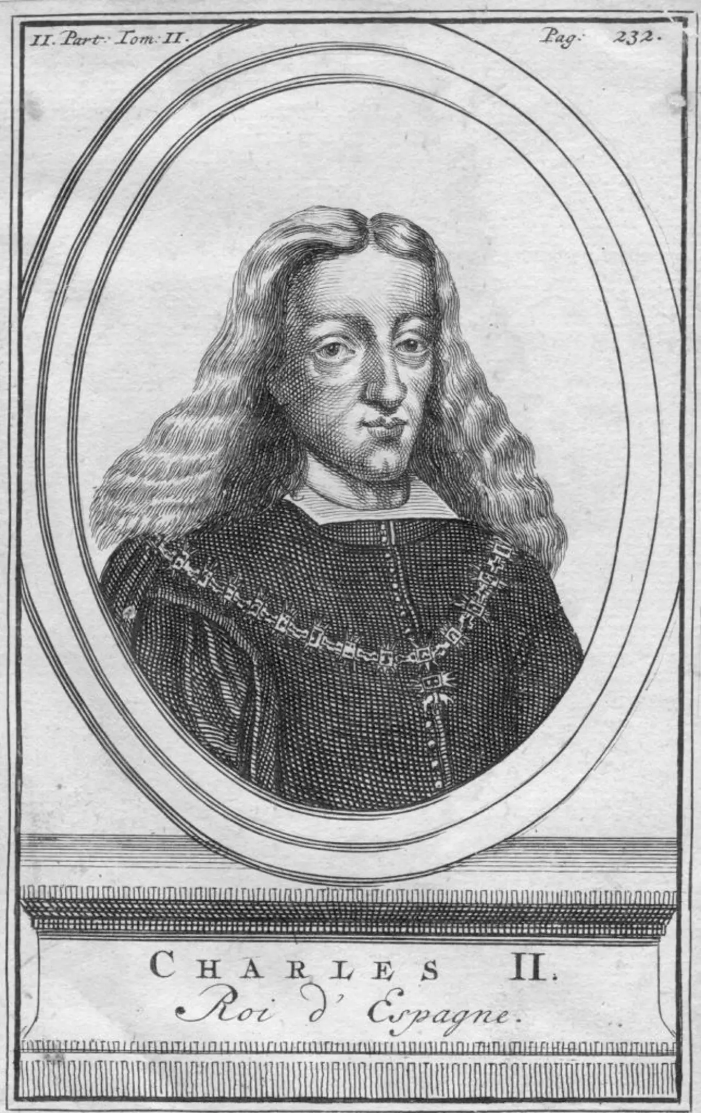 King Charles II of Spain, who ruled from 1665, was tragically born with a host of deformities (Hulton Archive/Getty Images)