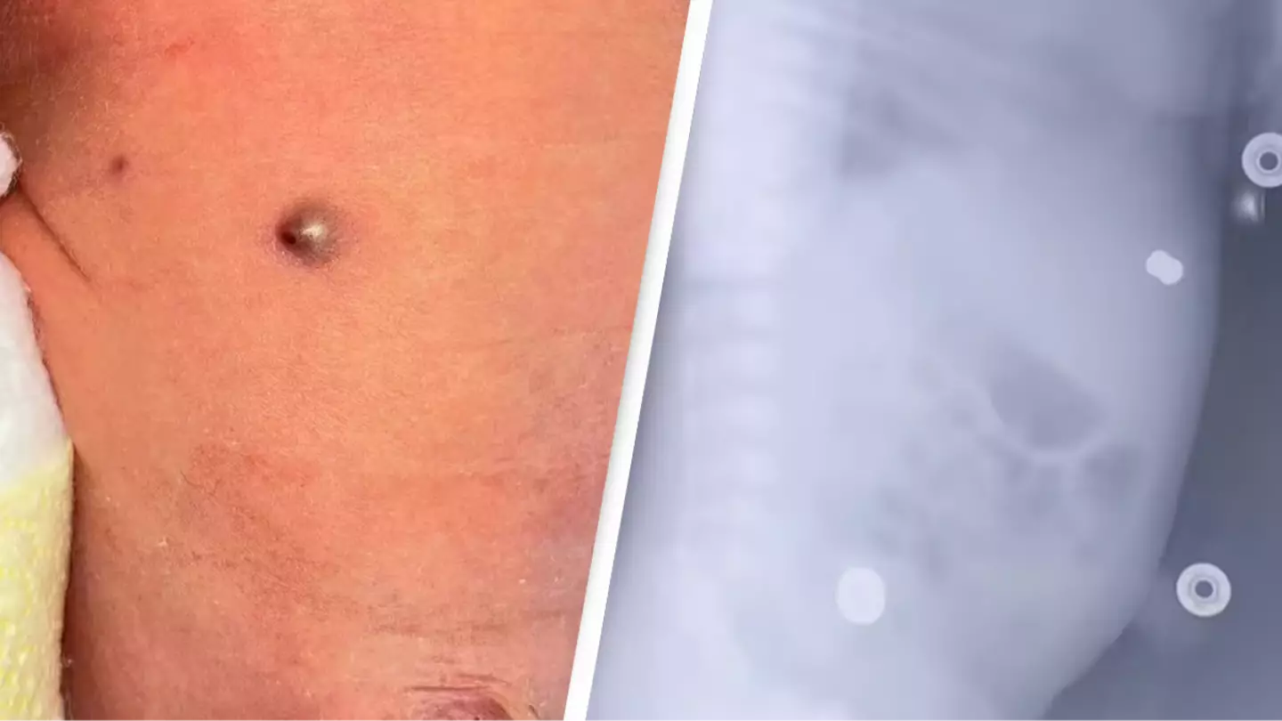 Baby is miraculously born with rifle pellet lodged in stomach after mother was shot