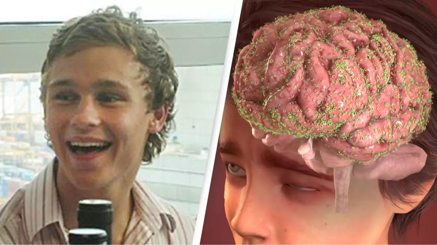 Horrifying simulation shows what happened to teenager after he was dared to eat live slug by his friends