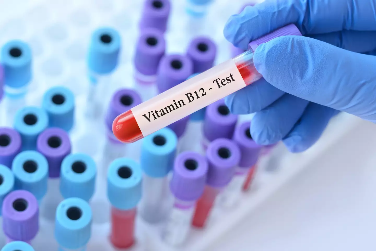 The teen had low Vitamin B12 levels (Getty Stock Images)