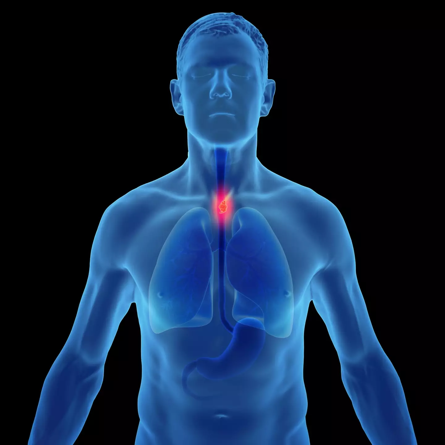 His symptom was dismissed by his doctor (Getty Stock Images)