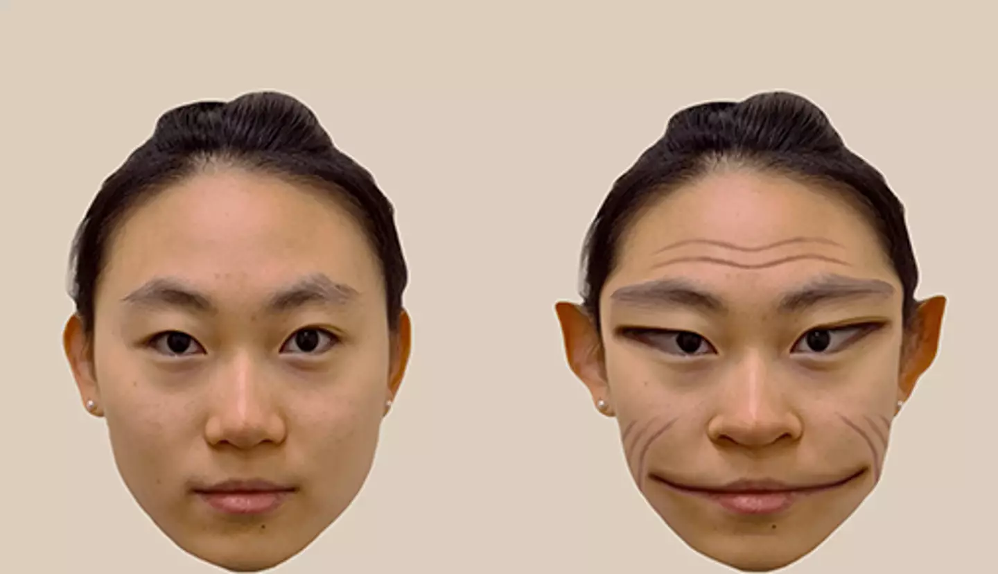 The condition is called prosopometamorphopsia (Antonio Mello/The Lancet)