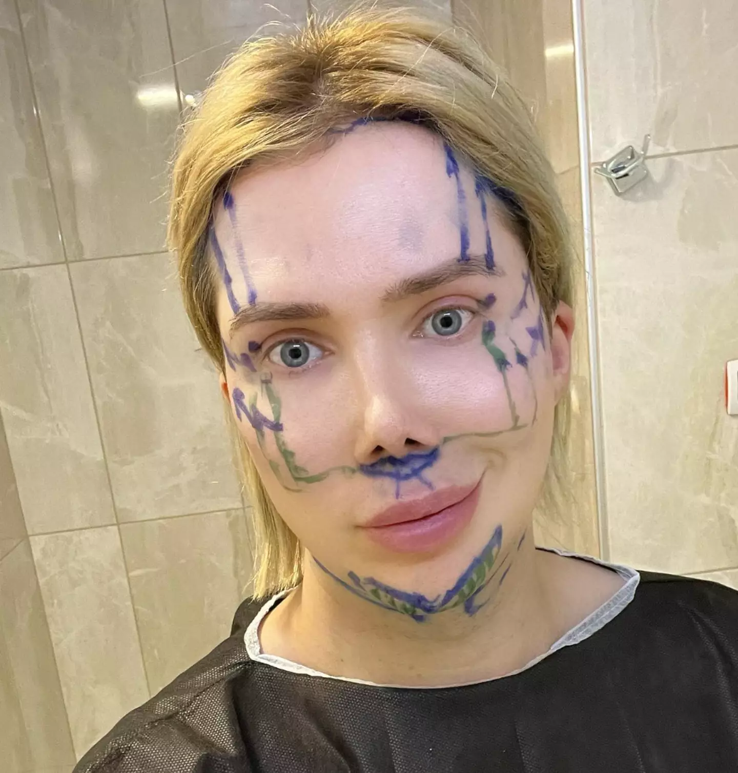 Oli had a lot of procedures on his journey.