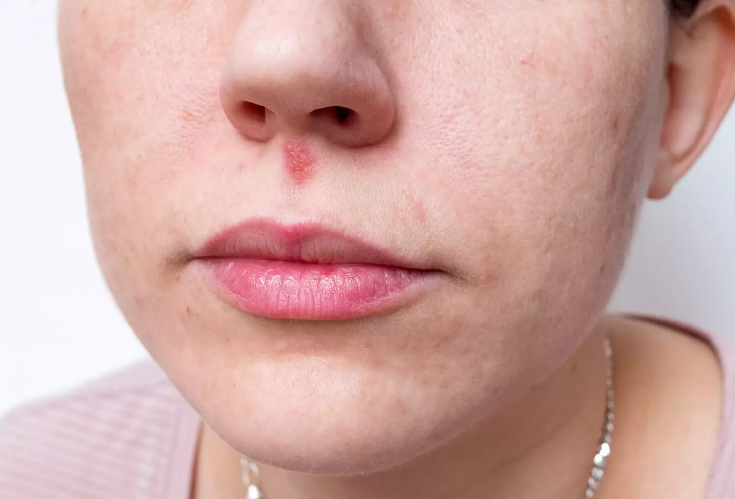 HSV-1 located in or around the nose may lead to dementia, according to the study (Getty stock)
