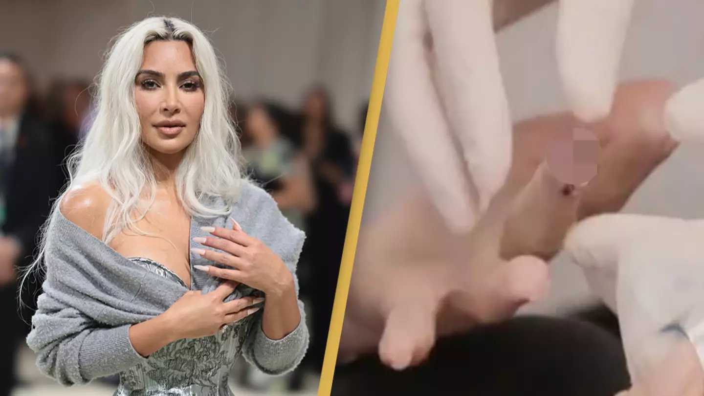 Kim Kardashian suffered shock injury that caused 'more pain than childbirth'