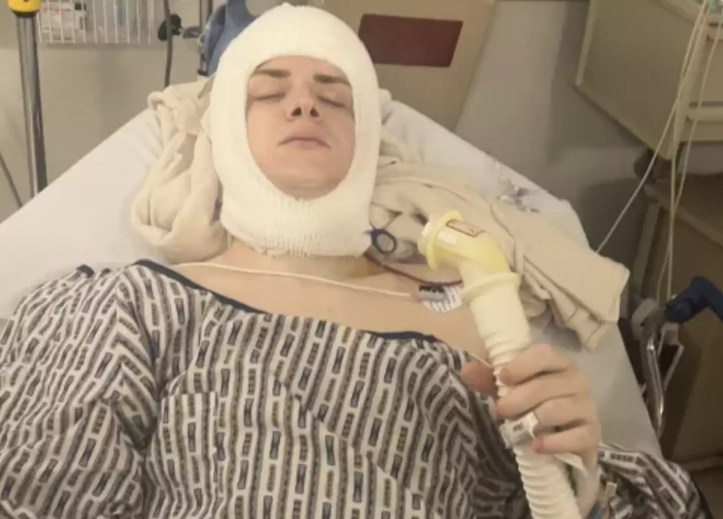 Brandon has 89 staples in his head from his last surgery.