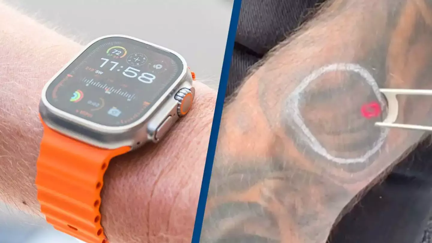 Mind-blowing reason you shouldn't wear a smart watch if you have a tattoo underneath