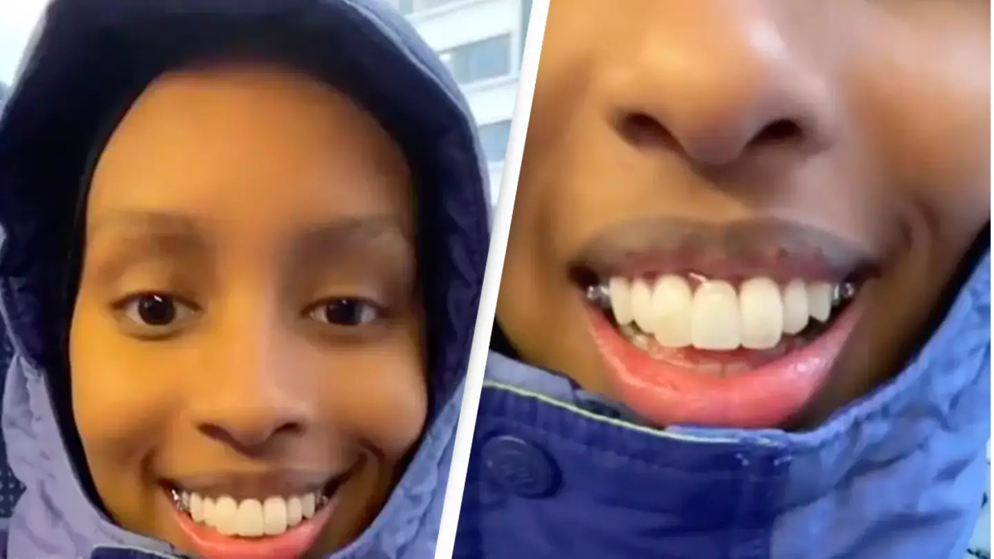 Beauty influencer explains why her dentist gave her three front teeth