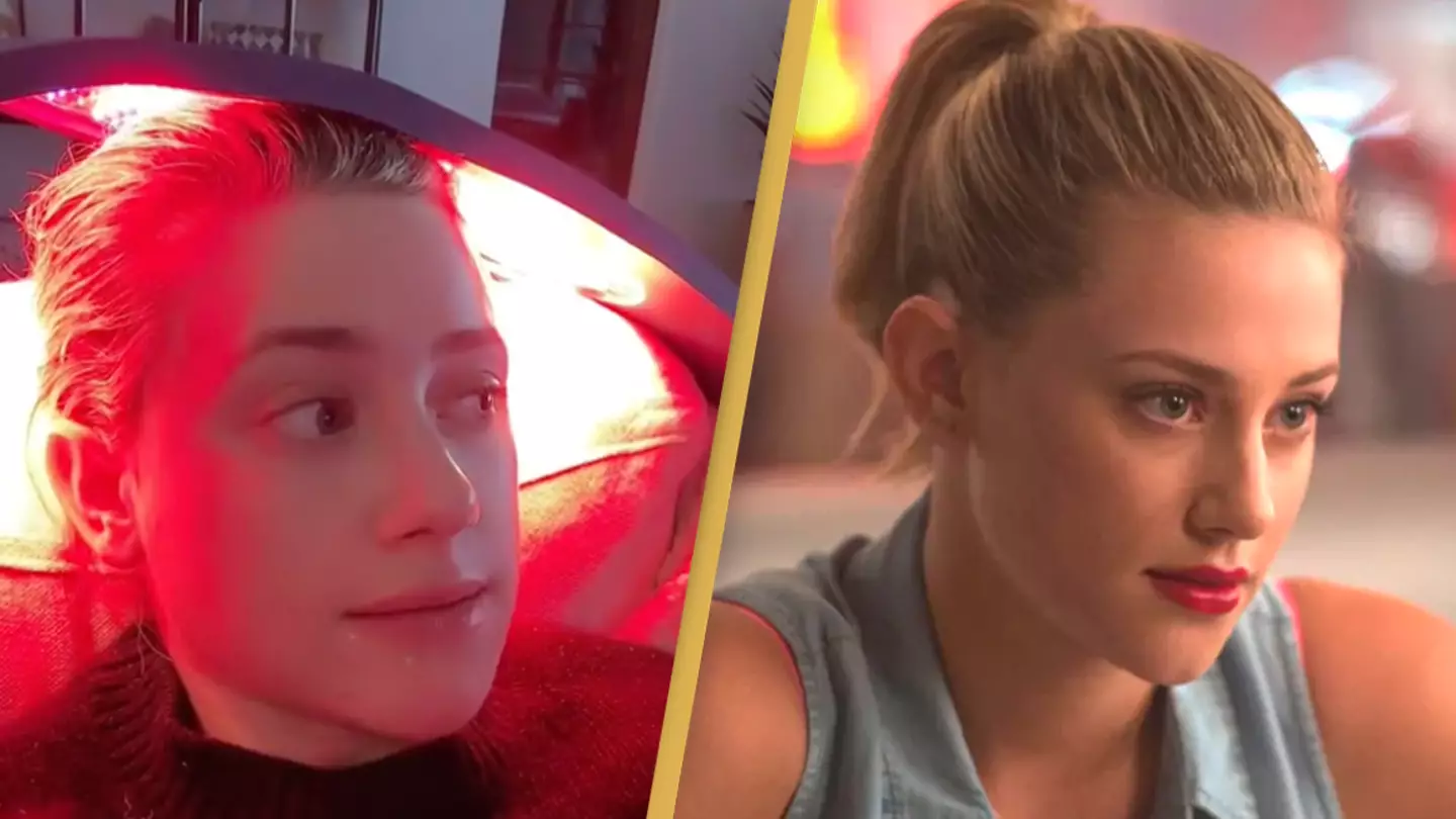 Riverdale star Lili Reinhart diagnosed with alopecia 'in midst of major depressive episode'