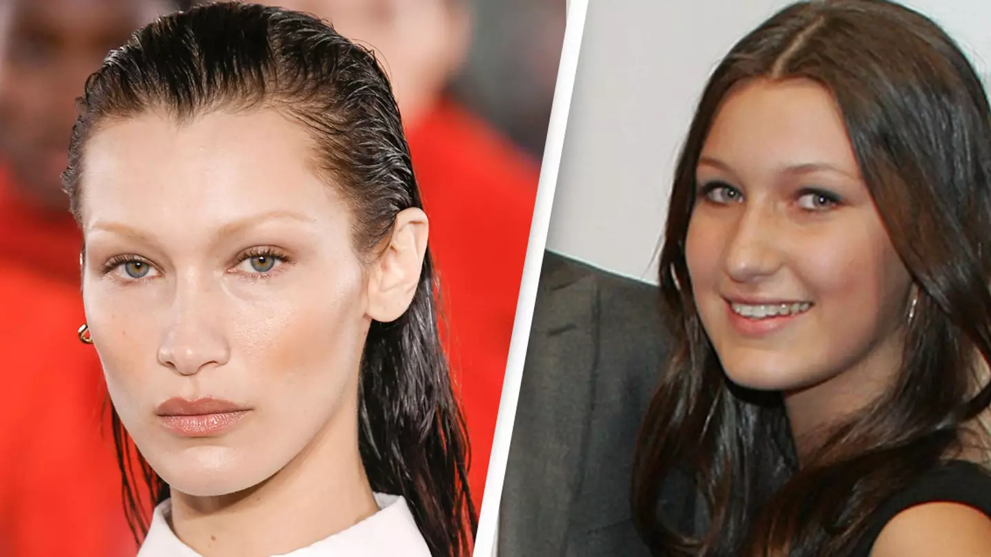 Bella Hadid Admits To Having Plastic Surgery Aged 14 After Feeling Like Gigi Hadid's 'Ugly Sister'