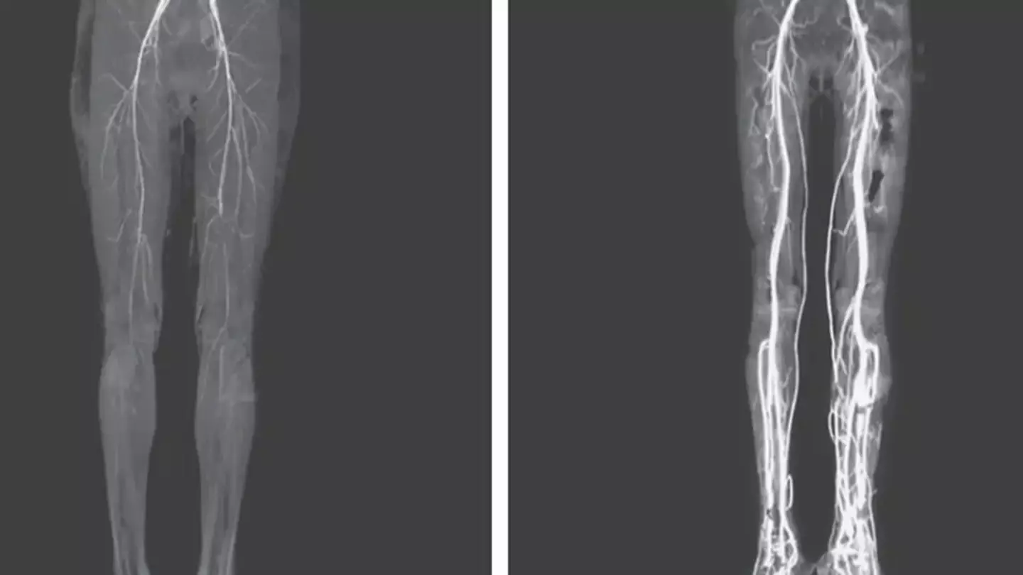 Woman experiencing burning pain in legs discovers she has ancient 'holy fire' disease