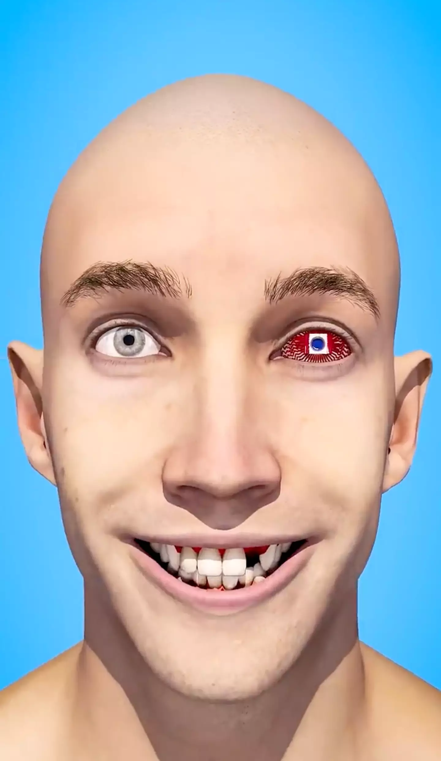 Presumably you would also get a crown for the lost tooth. (Reddit / ChairMeowOfficial)