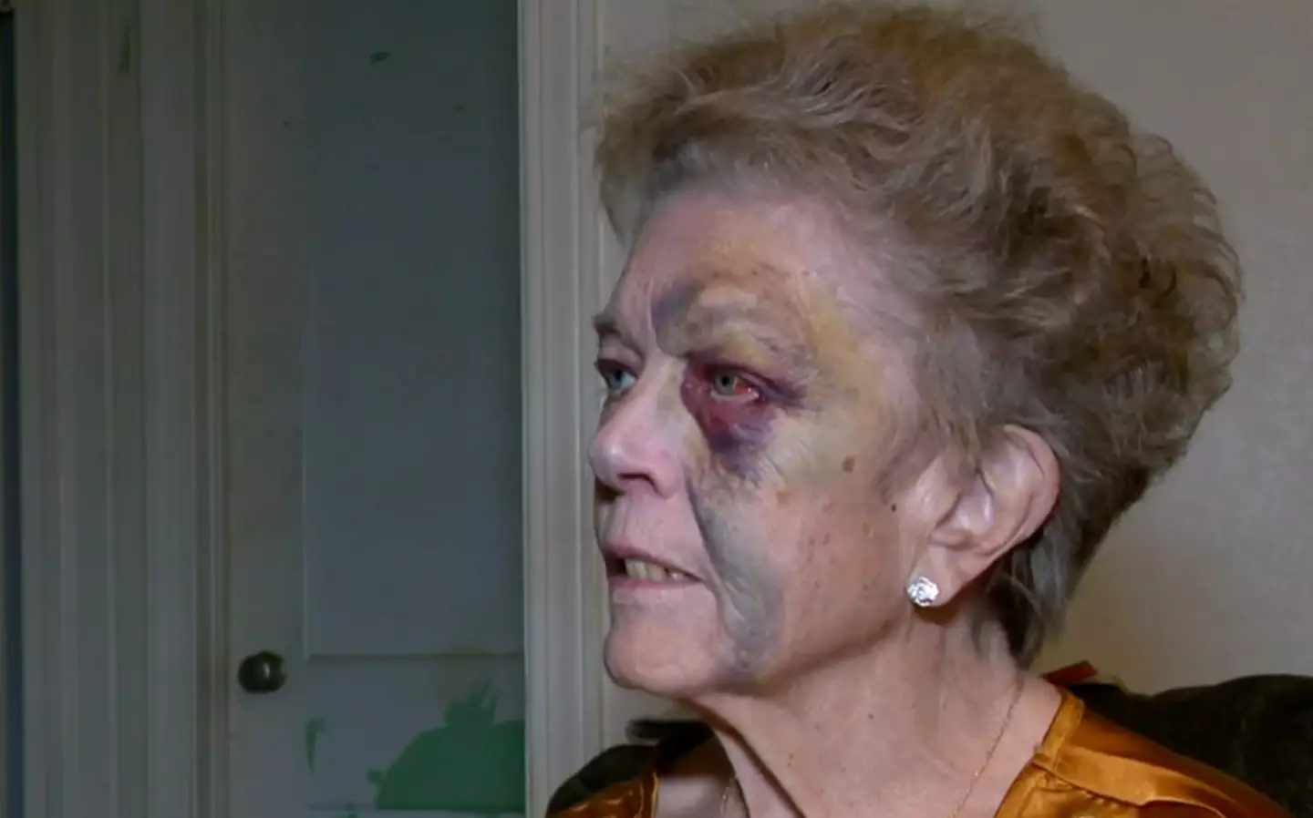 Shirlene Hernandez was left severely injured.