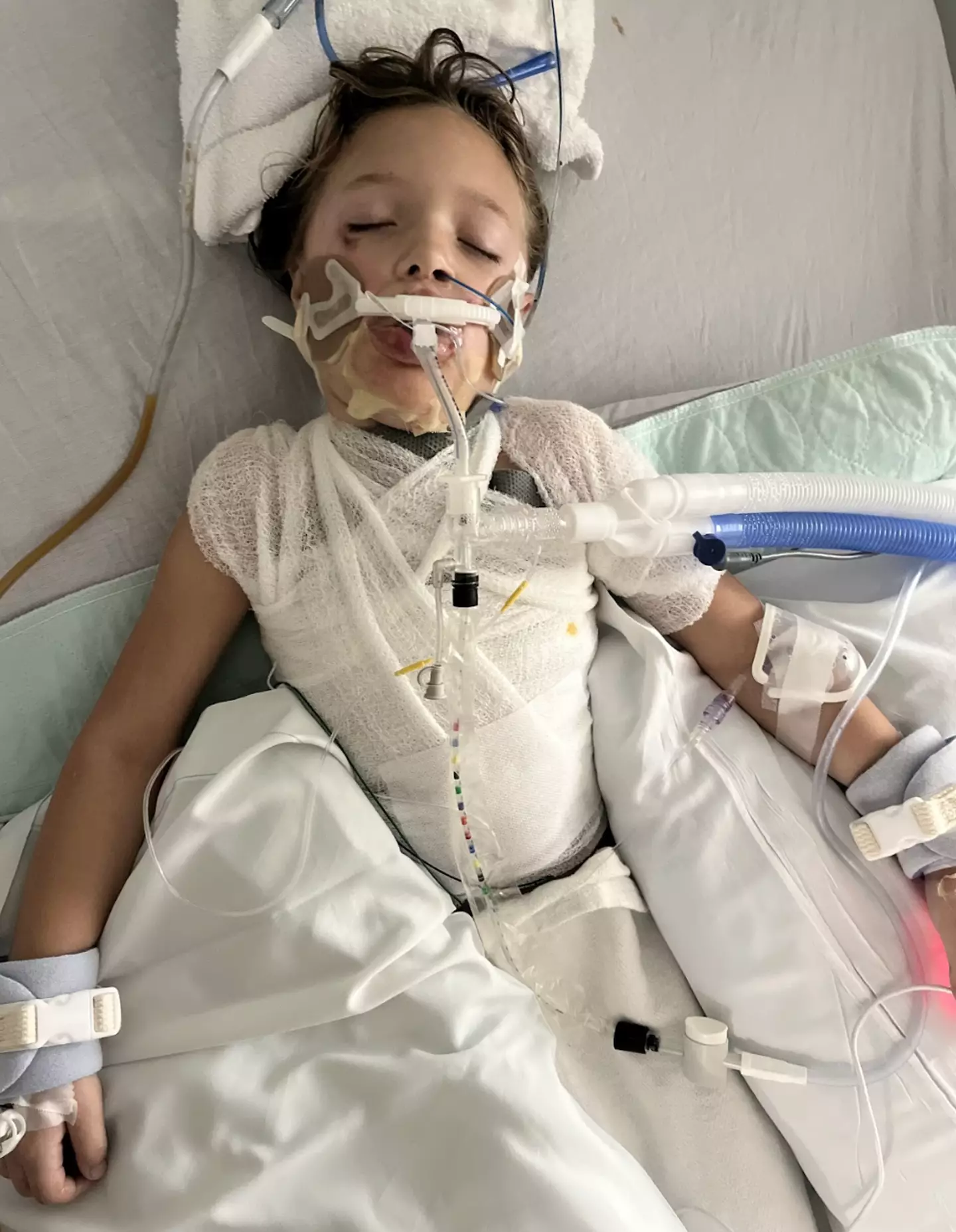 The young girl was in a coma for three days (Kennedy News)