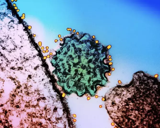 Thailand is just one of many Asian nations taking steps to prevent the spread of the Nipah virus ((NIH-NIAID/Image Point FR/BSIP/Universal Images Group via Getty Images)