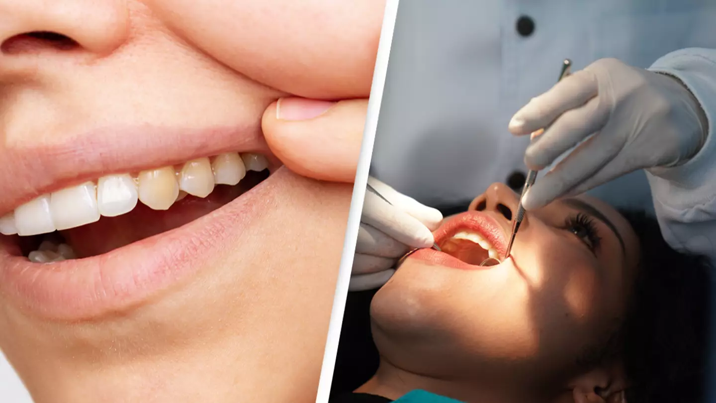 Dentist reveals common mistake people make that causes yellow teeth and how to avoid it
