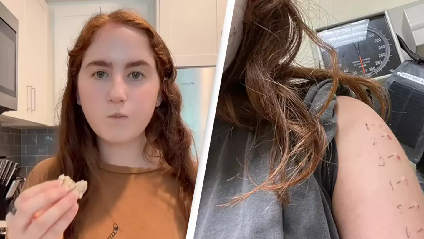 Woman limited to eating just 13 foods after discovering she has 100 different allergies