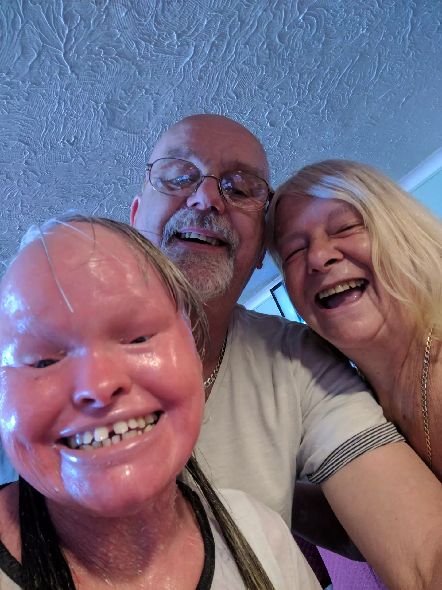 Hannah Bett's parents reflected on how 'inspirational' their daughter was.