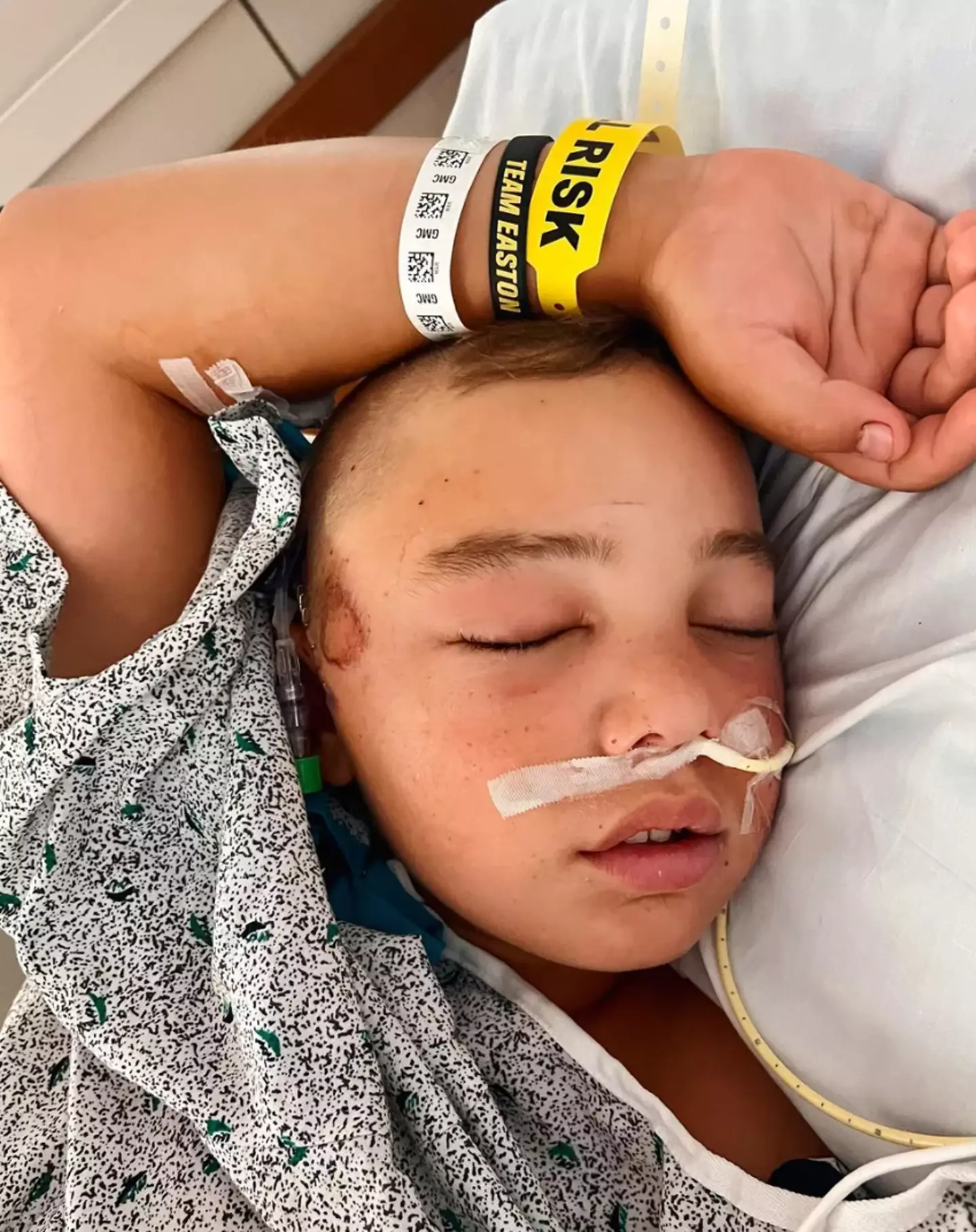 Easton ‘Tank’ Oliverson was minutes away from dying when he fell from a bunk bed and fractured his skull.