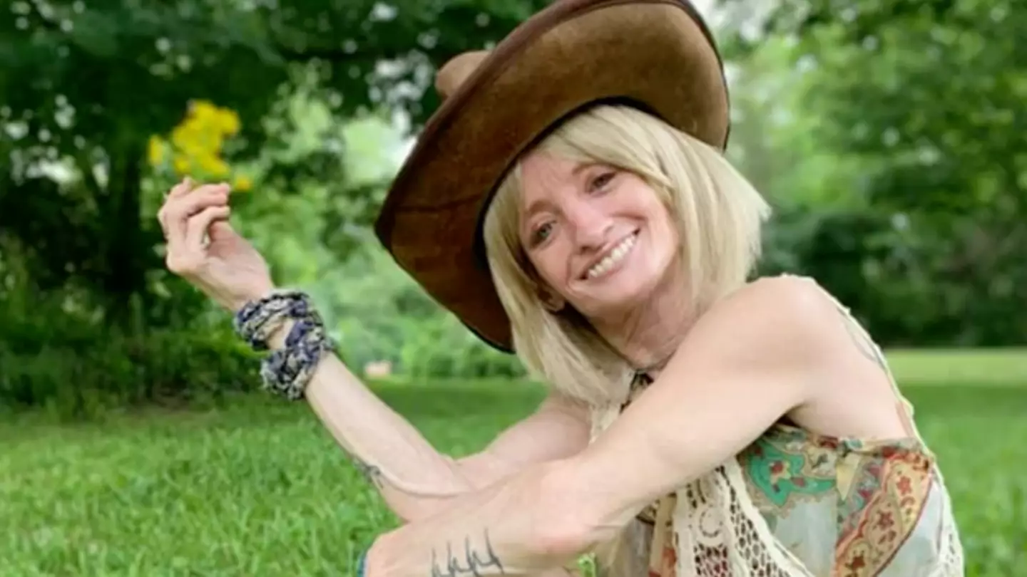 Woman opens up about living with rare 'Benjamin Button' condition that ages her eight times faster than normal