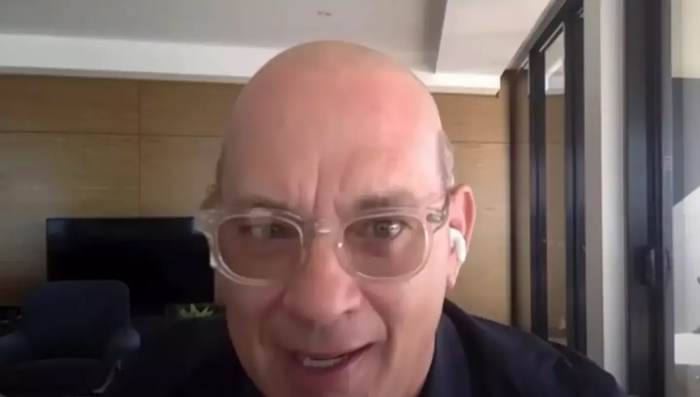 Tom Hanks and his very bald head.