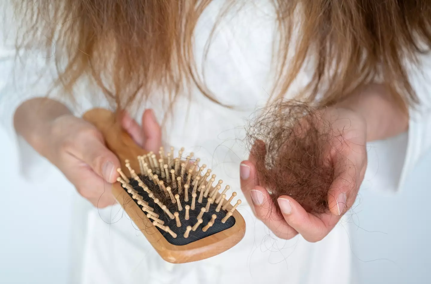 Hair loss affects a huge percentage of the population (Getty)