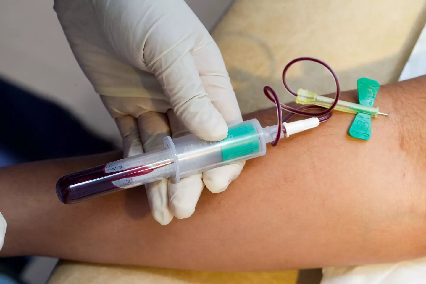 A blood test could drastically cut costs in detecting Alzheimer's. (Alamy)