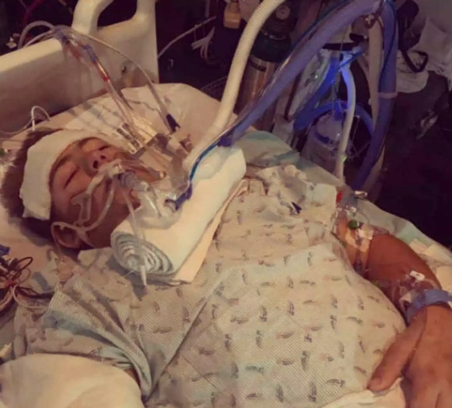 Loren seen after his accident (Instagram/@loren.schauers)