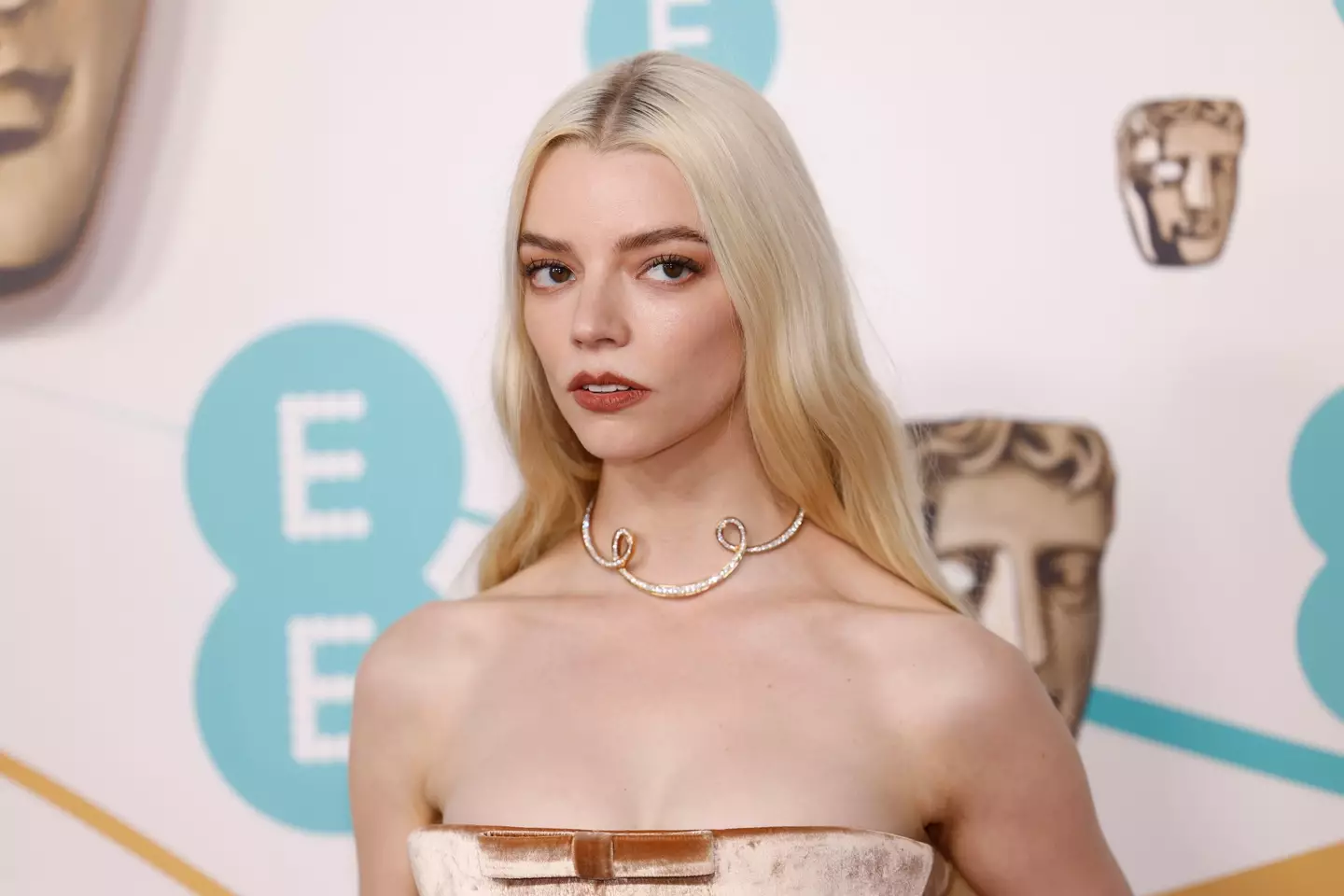 There's nothing wrong with her eyes.