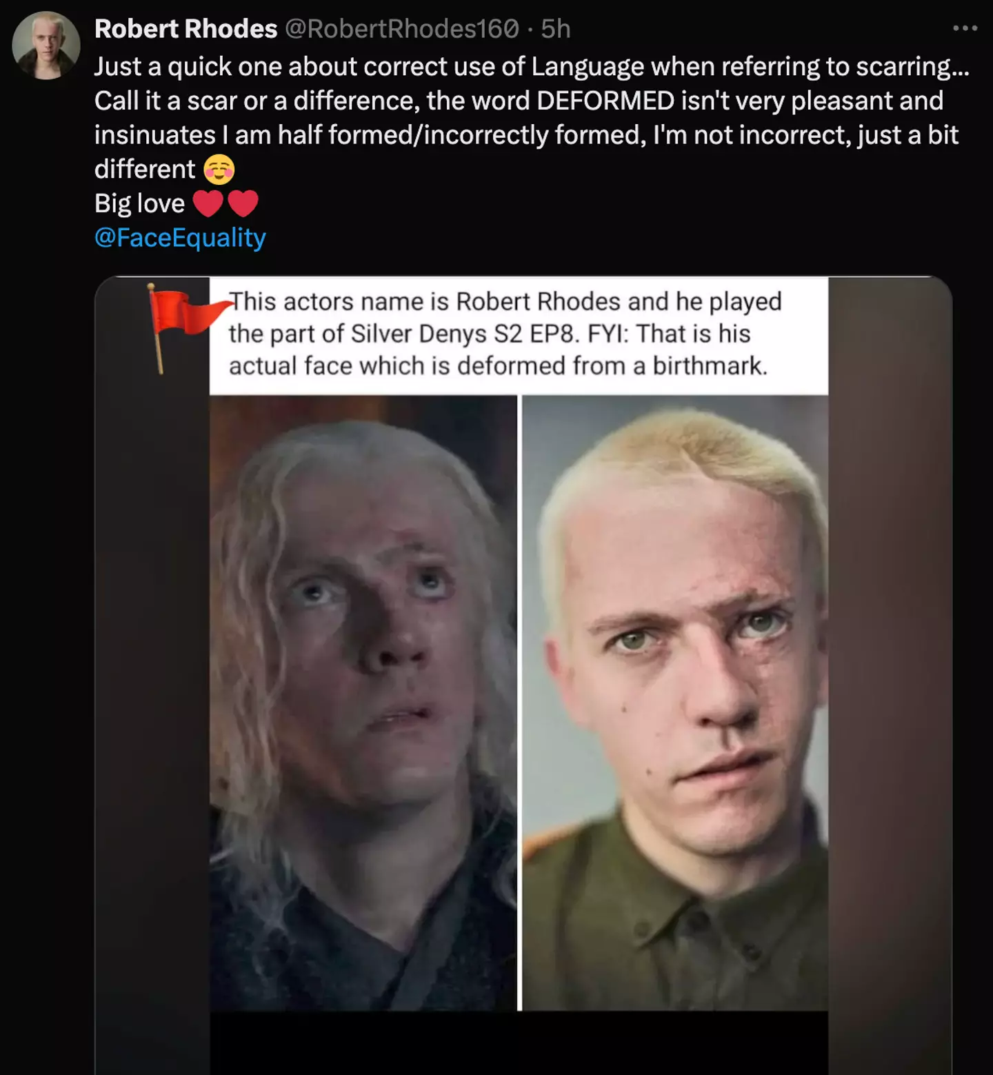 Rhodes pointed out there's certain language which can be hurtful (Twitter/ @robertrhodes160)