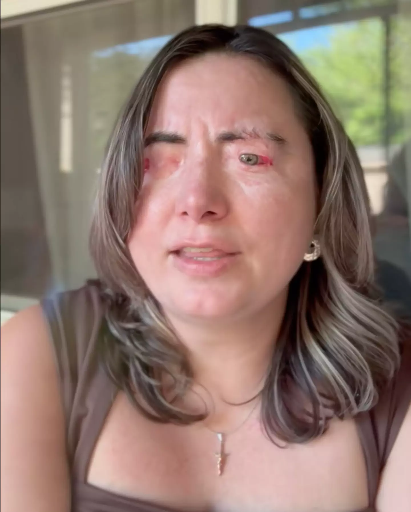 Heather Cornelius had chemicals poured into her eyes by her abusive husband (heathercornelius19/TikTok)