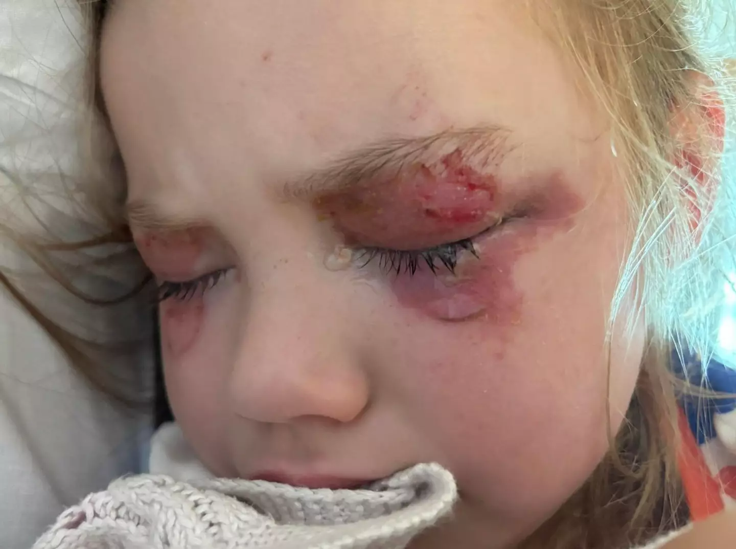 Thankfully Luca's sight is set to fully return (Kennedy)
