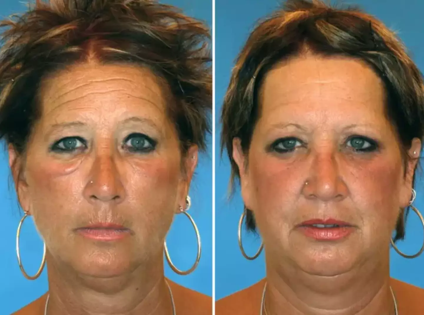 Barb (right) said she's often called 'the younger one' compared to her sister who smokes (NBC)