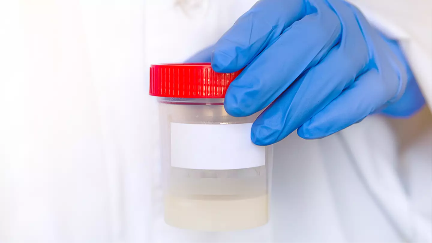 Man who unknowingly has rare cancer donated his sperm to over 60 families with heartbreaking consequences