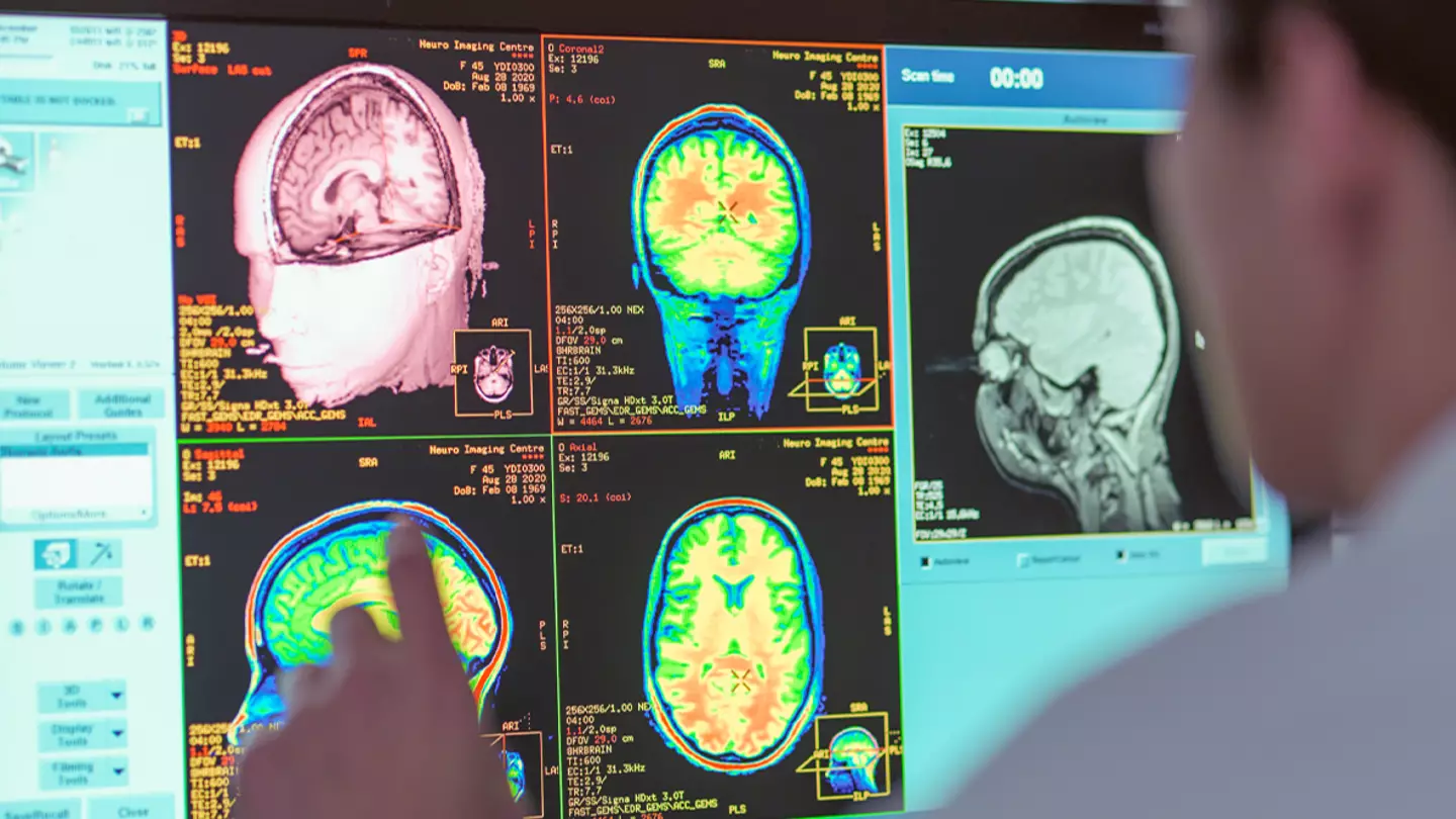 Scientists have discovered 'evidence' of human brain transporting souls when we die