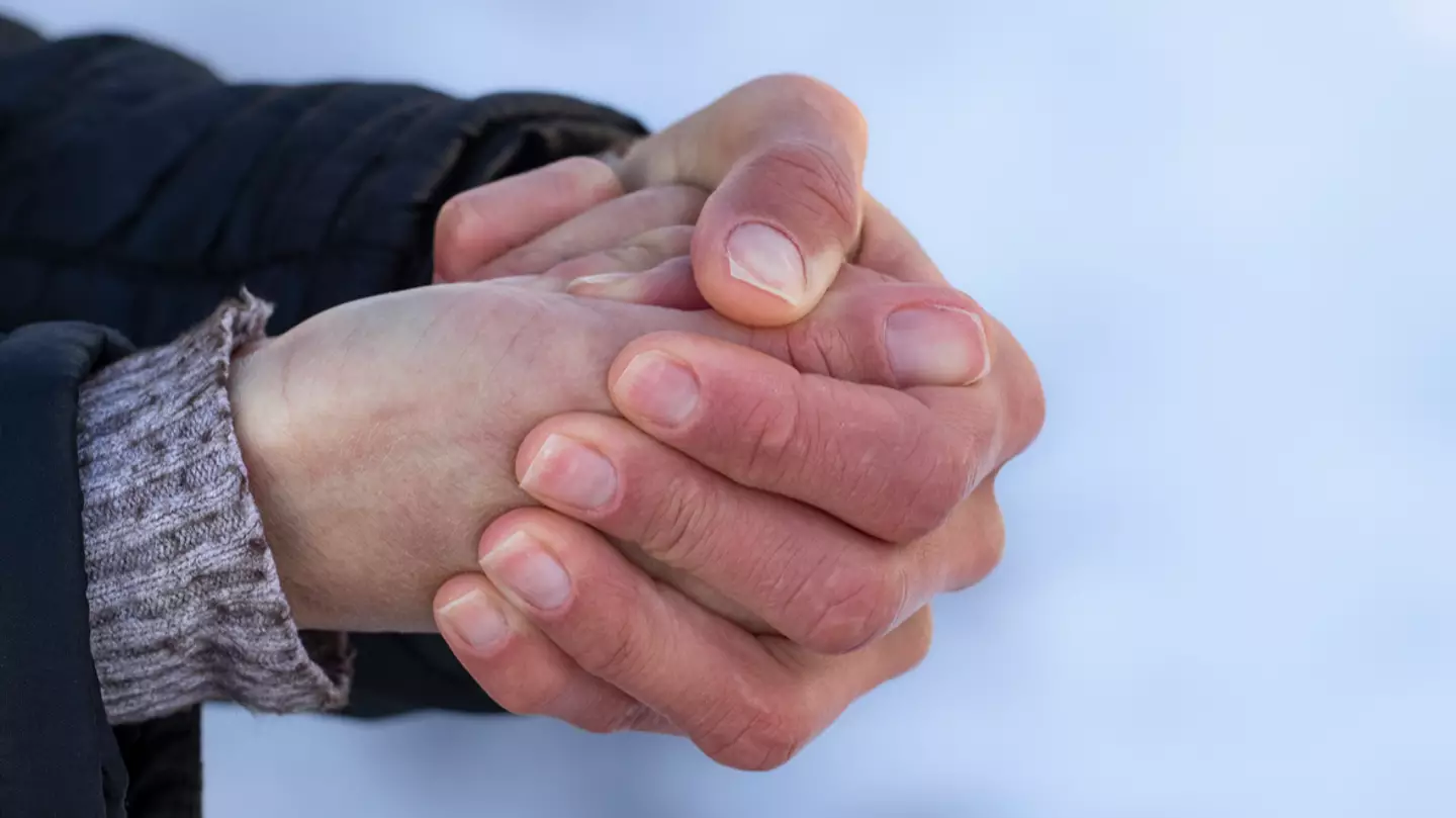 Doctor shares warning to people whose fingers and toes change color and feel numb in the cold