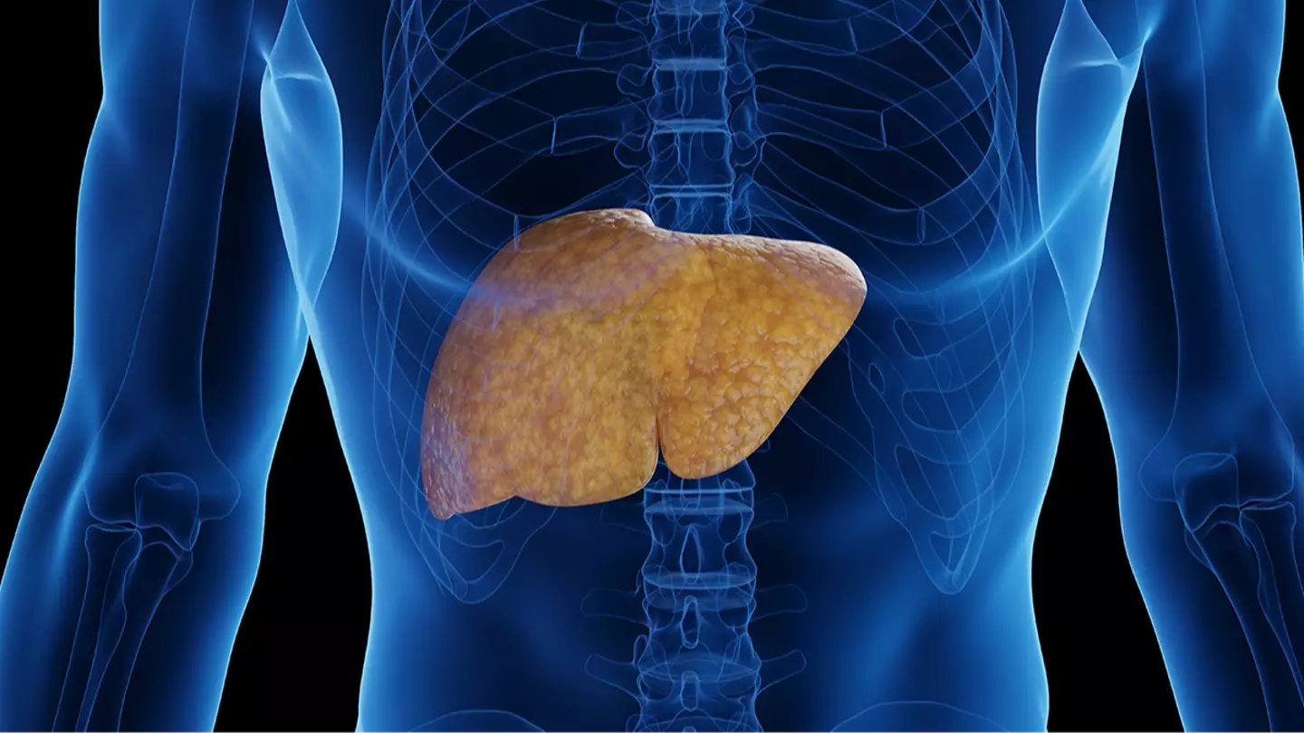 People are just learning of the most deadly disease that often goes undiagnosed by doctors