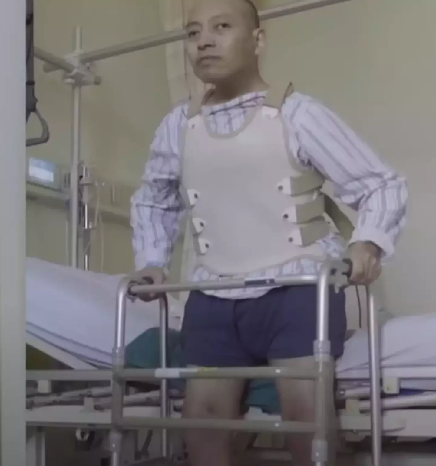 Li Hua after the surgery. (Shenzhen University General Hospital)