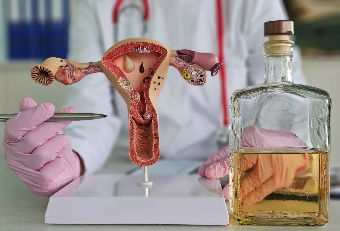 Portsmouth's heavy bleeding and pain was blamed on fibroids in her uterus (Getty Stock Image)