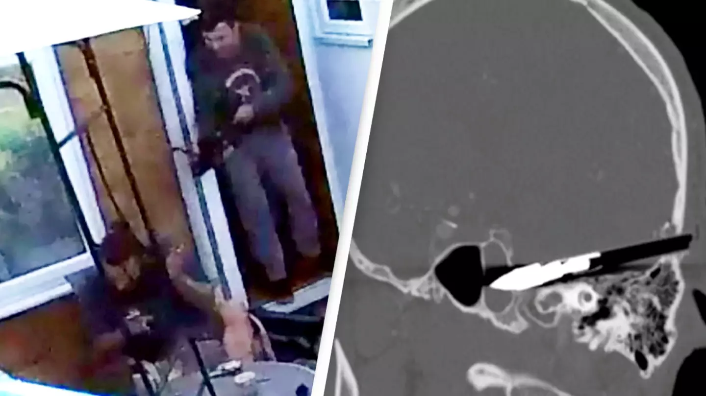 Footage shows moment man survived after being shot point-blank by a crossbow