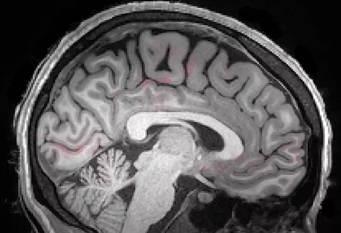 Images of the brain were captured for researchers to analyse how blood and cerebrospinal fluid moved while the person was sleeping (Laura Lewis, N. Fultz et al/Science 2019)