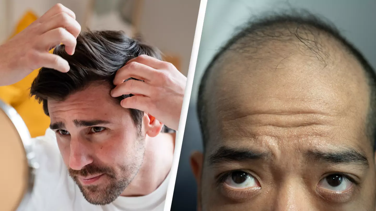 Doctor reveals one trait people have which makes them six times more likely to go bald