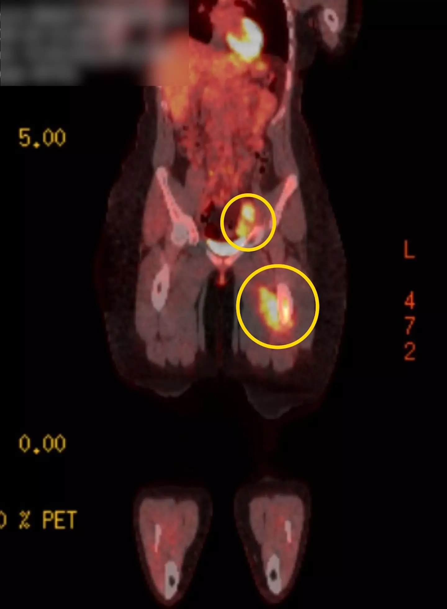 The scans showing the location of the tumors (Kennedy)