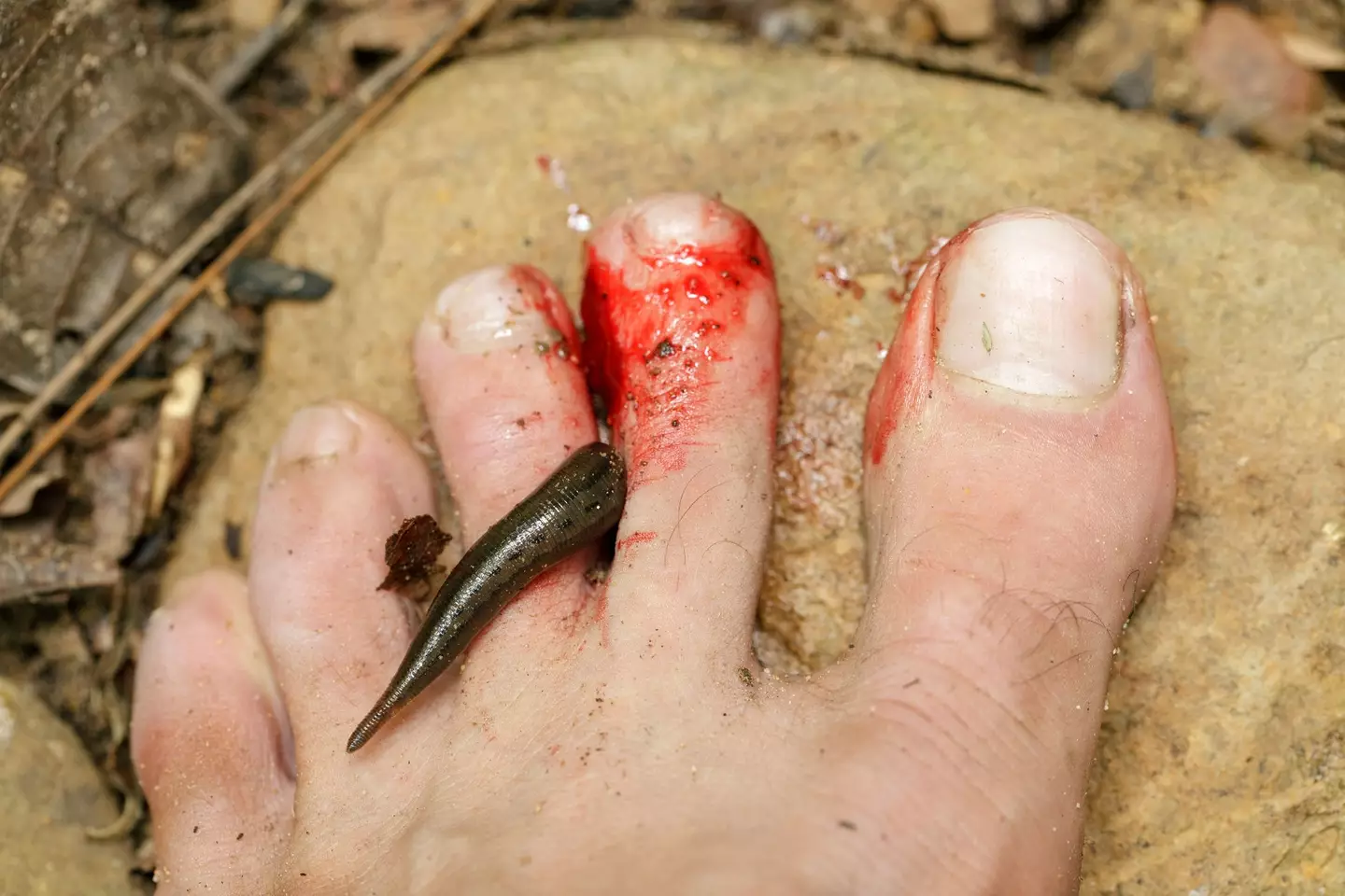 Leeches aren’t dangerous, but hosts rarely feel their bites.
