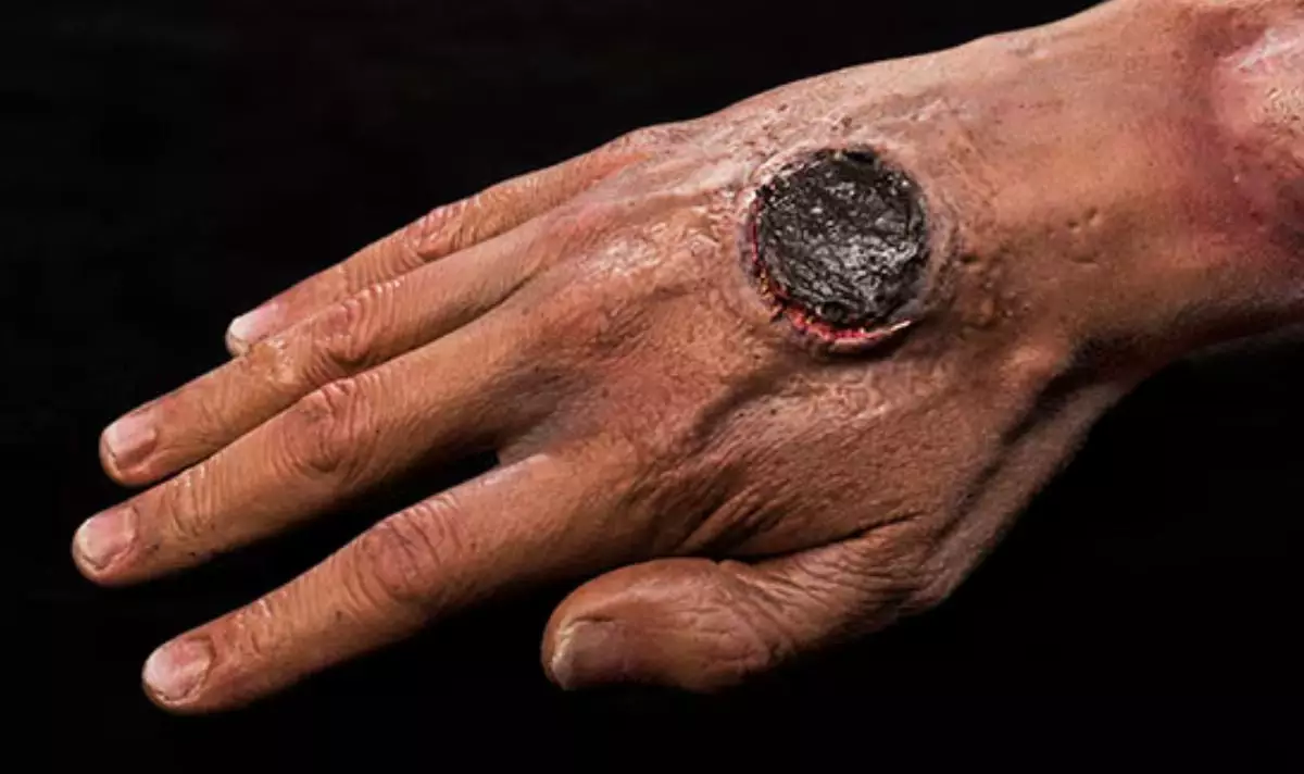 Tests found the man had been infected with anthrax. (CDC)