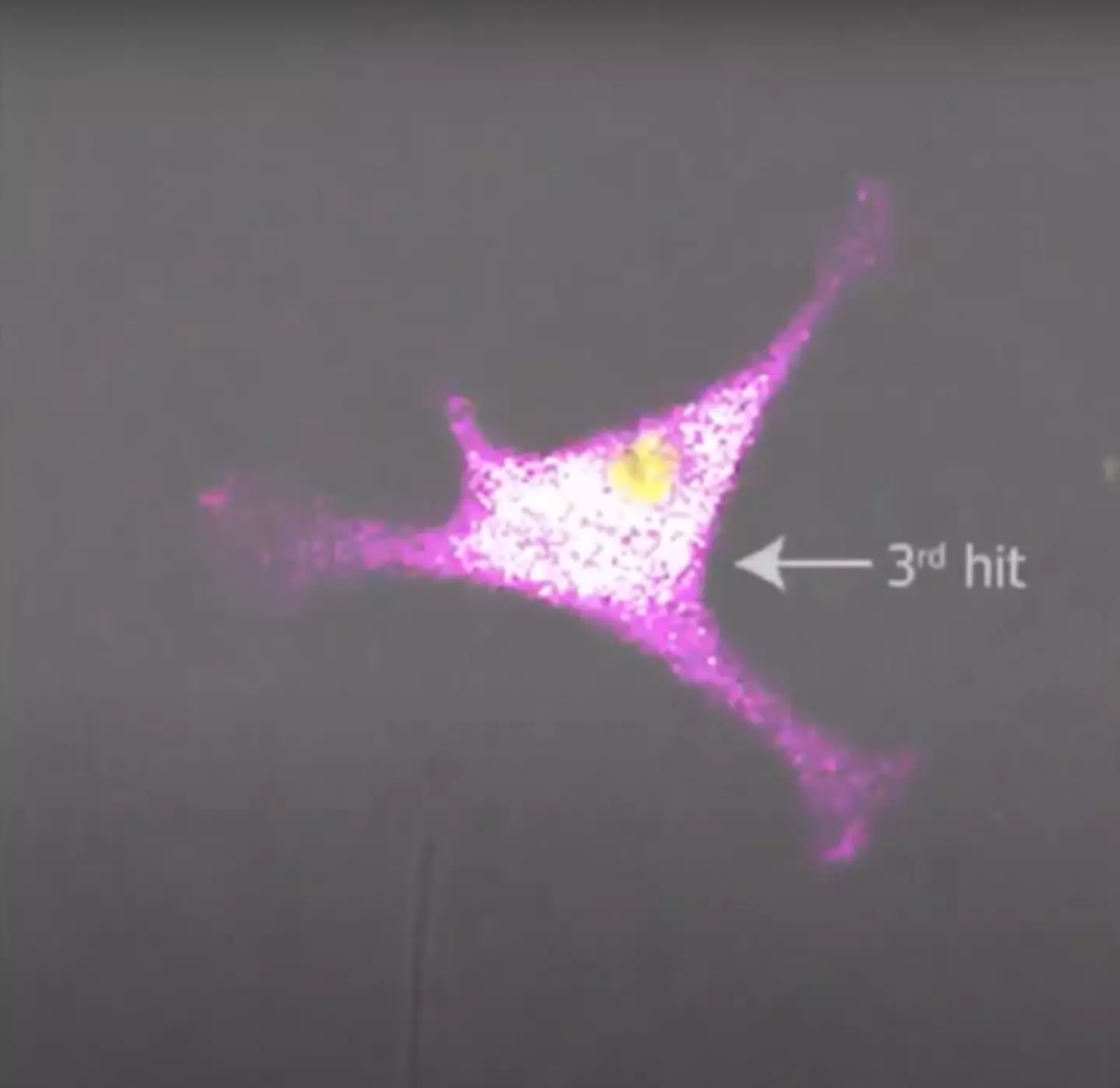 The video showed the T-cell attacking a cancer cell. (YouTube/Science Learning Made Easy)