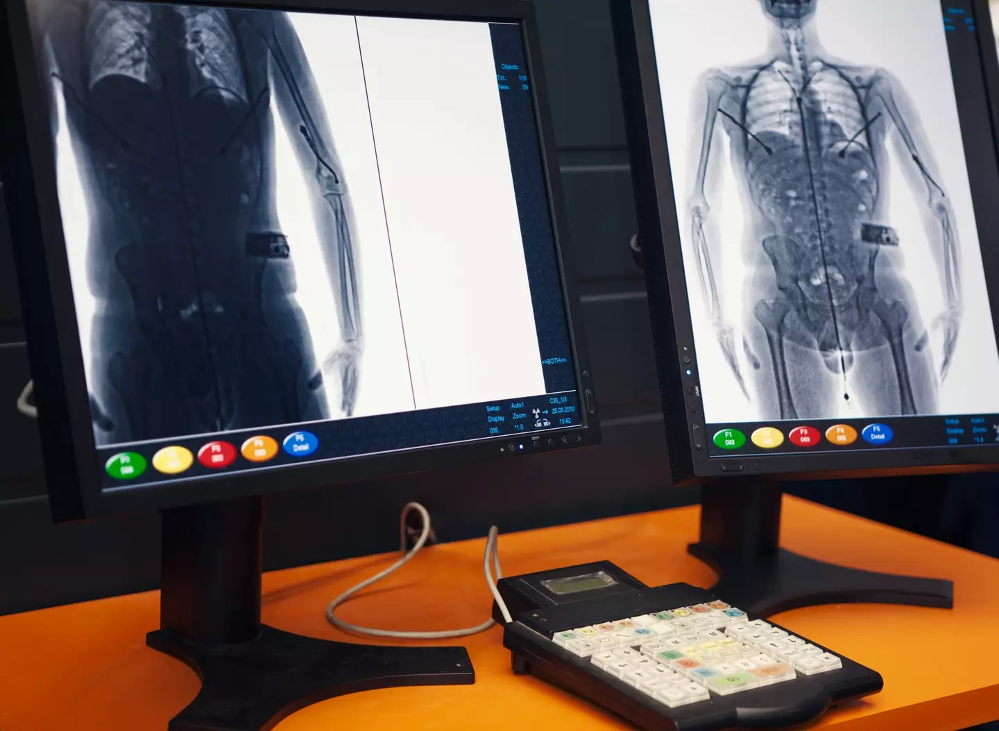 The scanners were showing up a bit more than everyone bargained for (Getty Stock Images/ Erlucho)