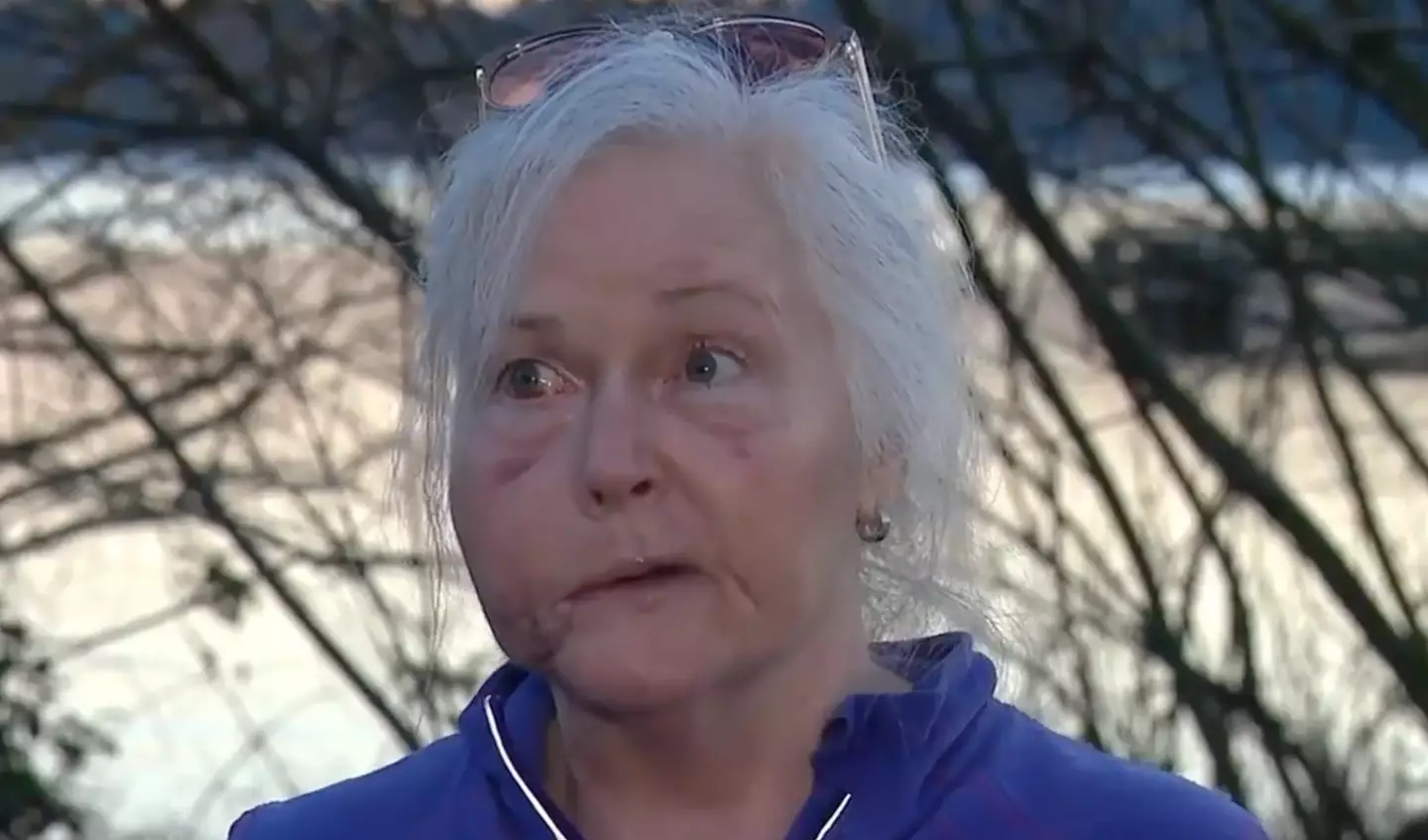 Keri Bergere was attacked by a cougar last year (KOMO News/YouTube)