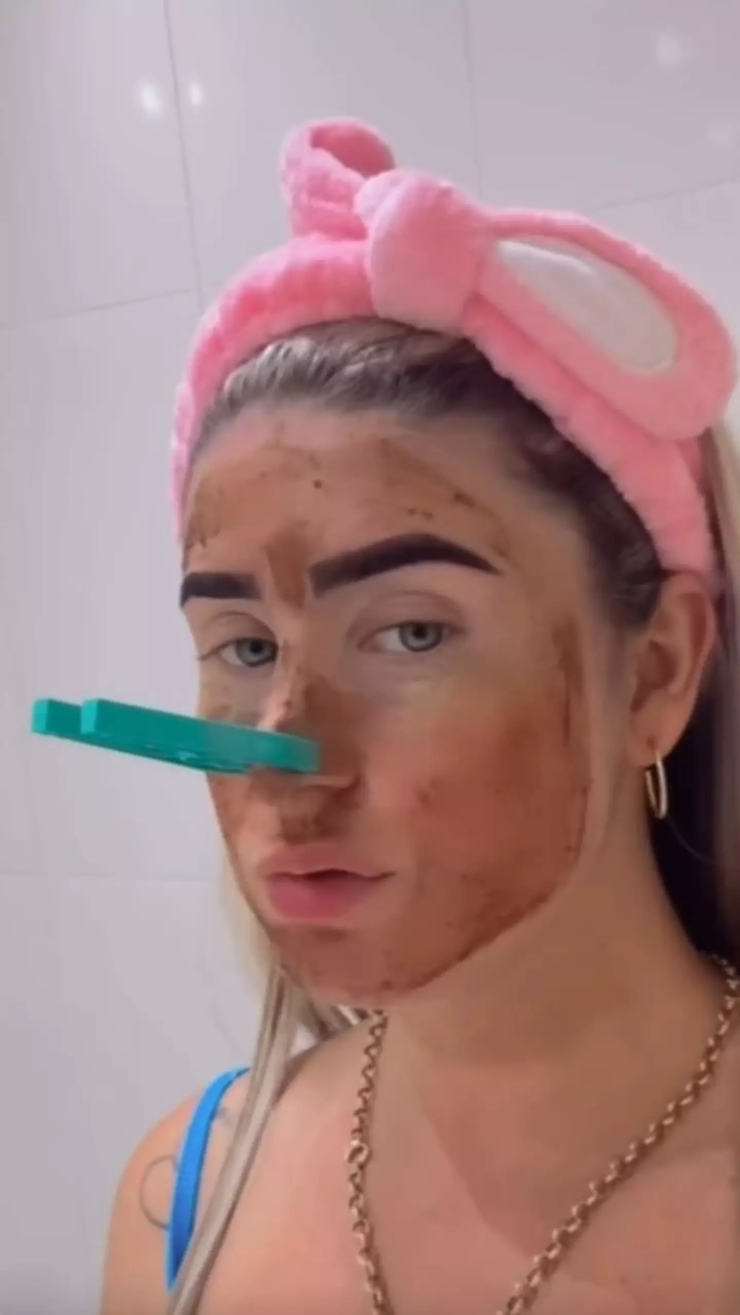 Health experts have warned against the 'trend'. (Jam Press)